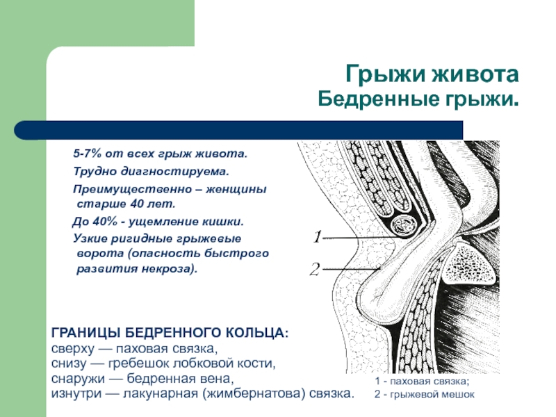 Бедренная грыжа. Грыжевое содержимое бедренной грыжи. Ущемленная мошоночная грыжа. Грыжевые ворота бедренной грыжи. Операция паховая мошоночная грыжа.