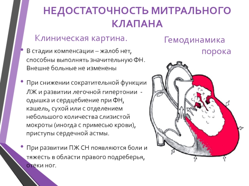 Митральная недостаточность