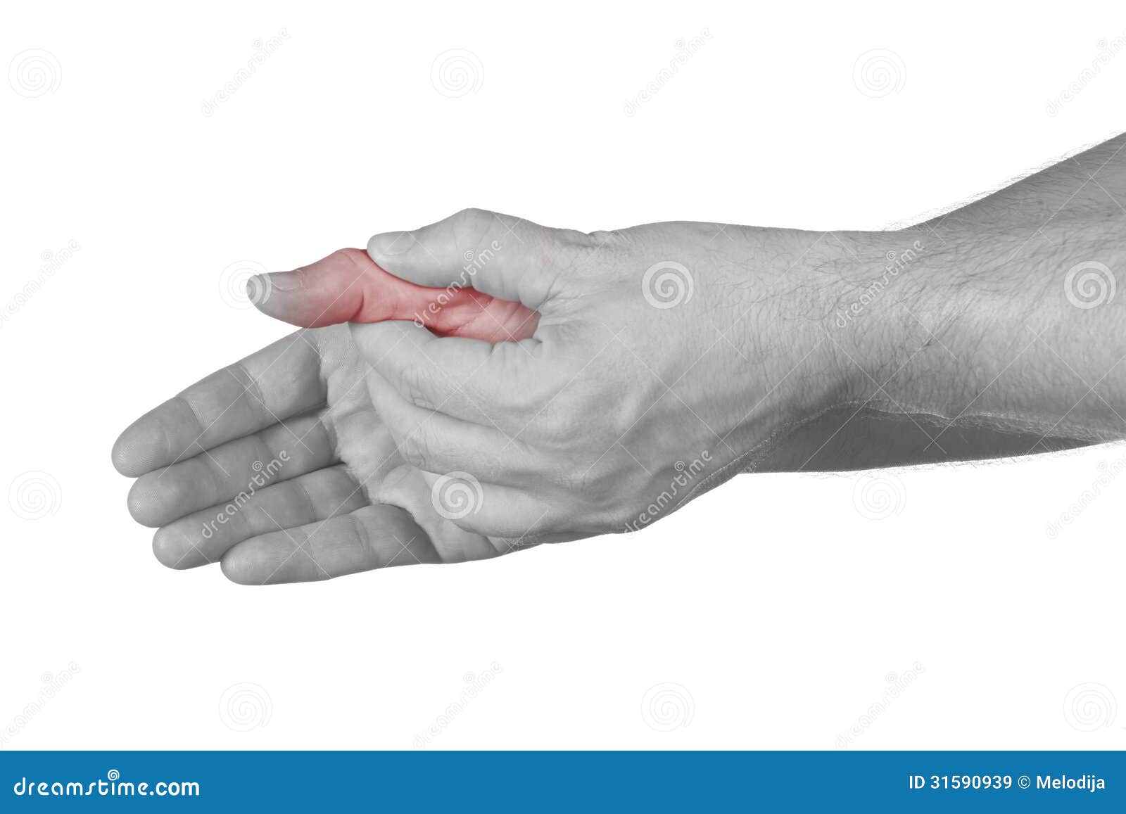 Сустав большого пальца руки. Боль в суставе большого пальца руки. Болит сустав большого пальца на руке. Болит сустав Болшево пальца на руке.