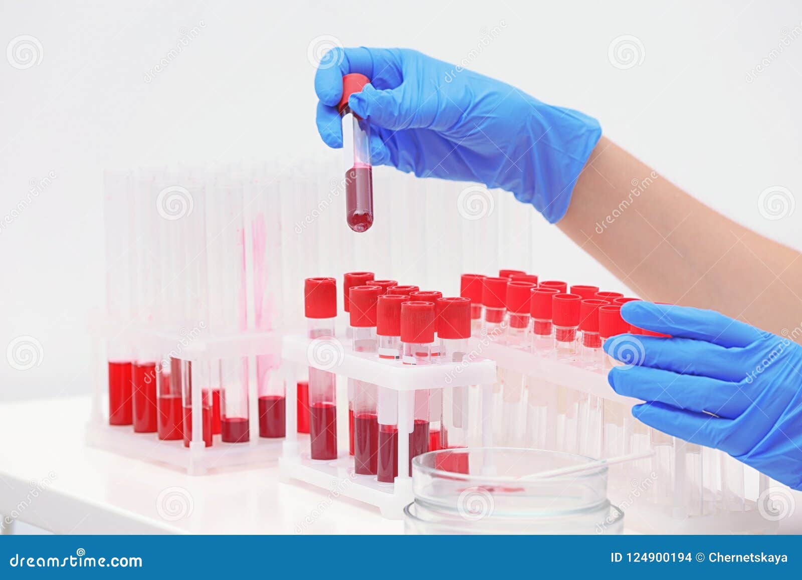 Много анализов. Пробирки с кровью в лаборатории. Лаборант с кровью. Пробирки для забора крови в штативе. Пробирки с кровью в штативе.