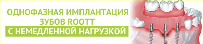 Отек после установки зубного импланта, как лечить и когда обратиться к врачу