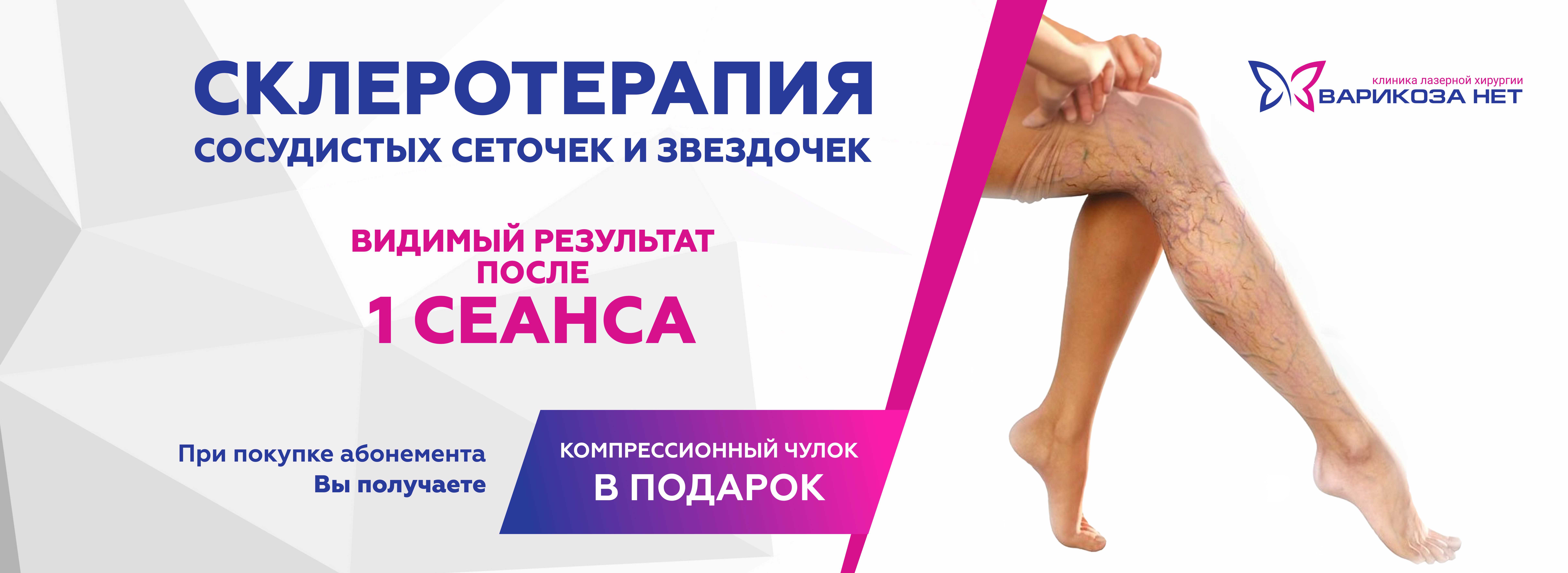 склеротерапия вен ног