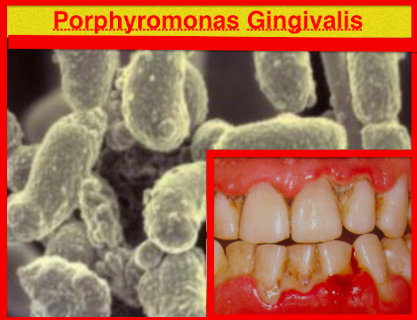 Porphyromonas gingivalis. Порфиромонас Гингивалис микробиология. Bacteroides gingivalis. Порфиромонады род Porphyromonas. P. gingivalis пародонтит.