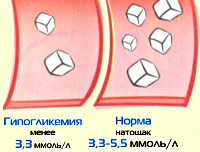 Гипогликемическая кома