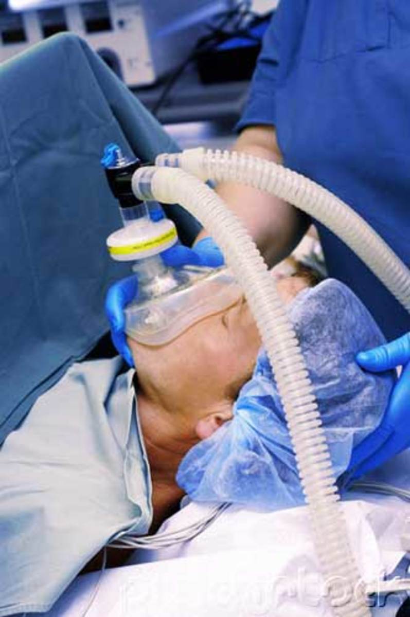 Во время операции под общим наркозом. Трубка для искусственной вентиляции легких. Аппарат искусственной вентиляции легких с трубкой.