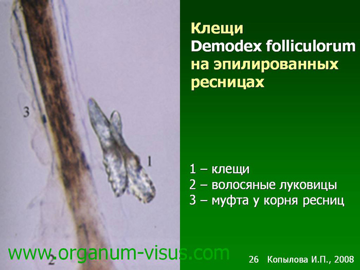 Демодекс клещ лечение схема