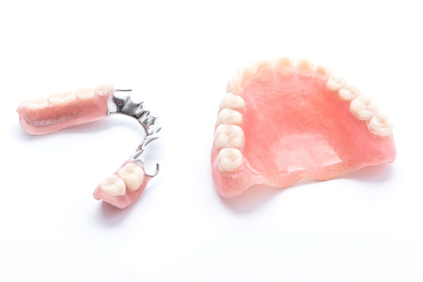 Prosthetics of Patients with partial loss of Teeth with Removable Dentures