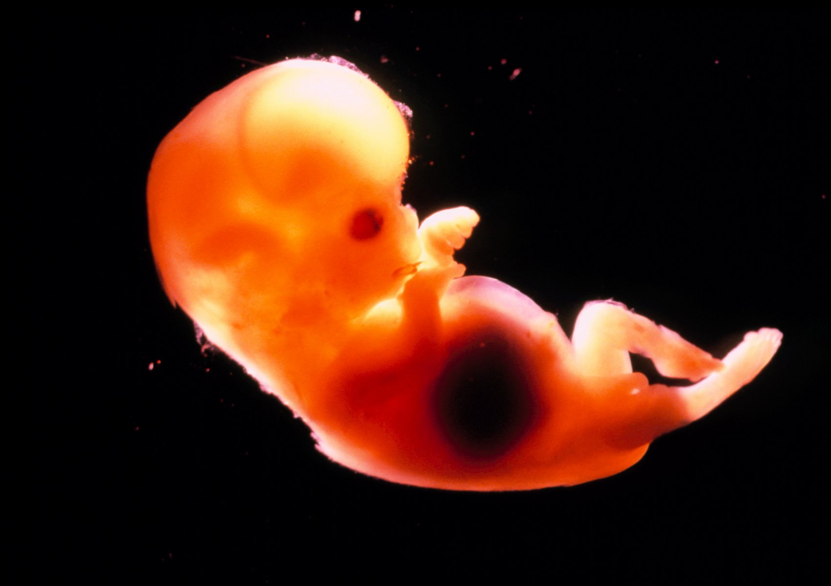 как выглядит эмбрион на 5 день