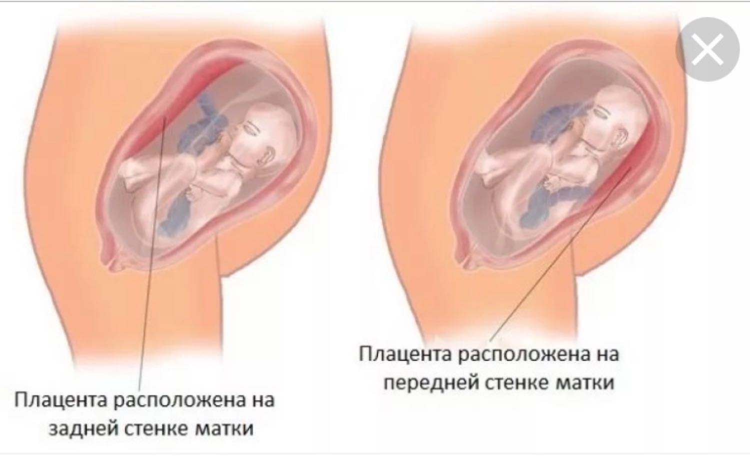 тонус матки при беременности и оргазм фото 105