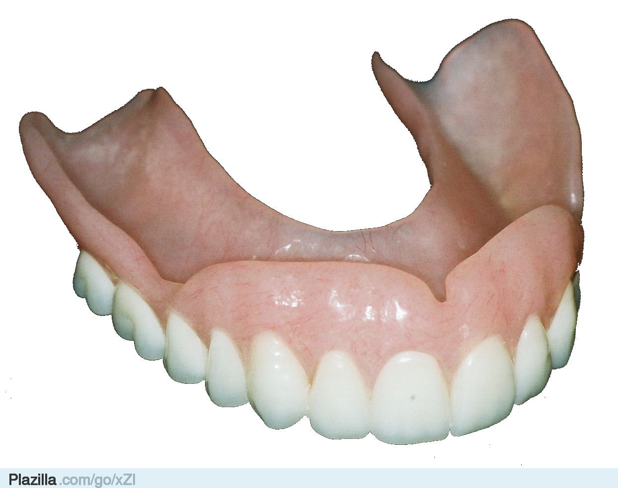 Съемный протез зубов какие бывают. Немецкие зубные протезы.