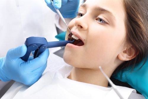Лечение зубов детям с анестезией