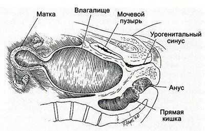 Строение вагины. Рассечение урогенитального синуса. Урогенитальный синус у девочек.