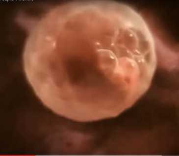 Подсаживали 2 эмбриона. Бластоциста 2бб. Эмбрион на 5 сутки эко. Бластоциста на 5 день. Матка и эмбрион после эко.