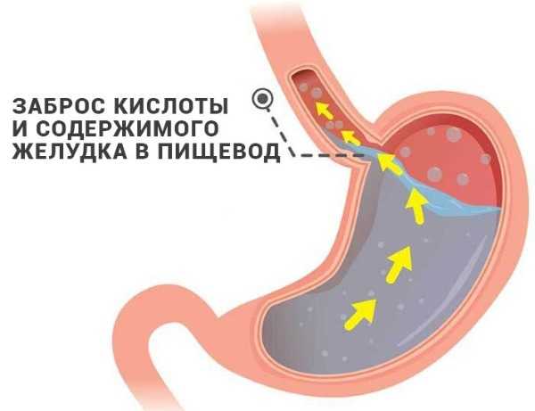 Анальный сфинктер фото