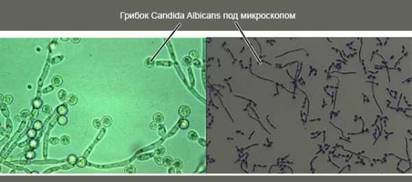 Кандида зева. Вагинальный кандидоз под микроскопом. Дрожжеподобные грибки рода Candida. Кандида альбиканс микроскопия. Кандида альбиканс в микроскопе.