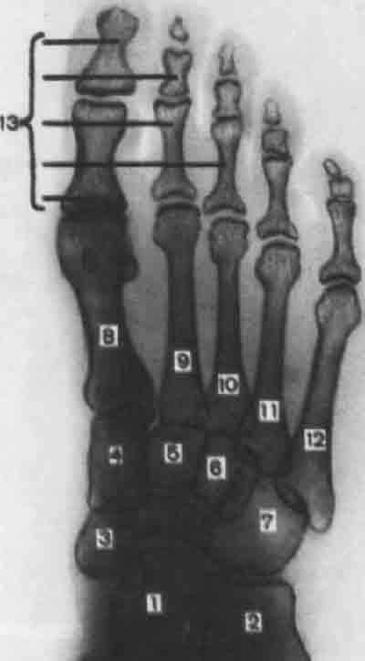 Проекции рентгена стоп. Кости предплюсны рентген анатомия. Кости стопы рентгеноанатомия. Рентгеноанатомия плюсневых костей. Рентгенограмма левой стопы в прямой проекции.