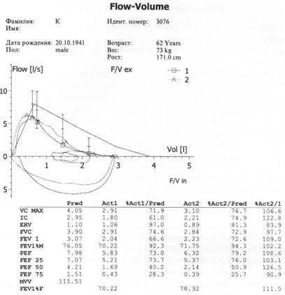 Заключение спирометрии образец