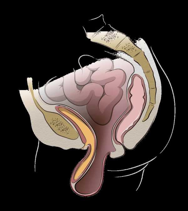 Опущение органов малого таза. Пролапс органов малого таза. Выпадение органов малого таза. Пролапс тазовых органов у женщин. Пролапс органов малого таза операция.